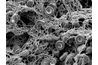 Vue microscopique de fibrine et de plaquettes formant un caillot